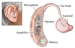 hearing aid